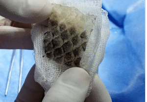 Piel de tilapia esterilizada y lista para ser sellada, usada como apósito biológico en heridas crónicas.