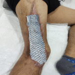 tratamiento de piel de tilapia